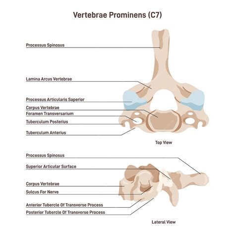 Vértebra Prominente Anatomía De La Séptima Vértebra Cervical C7