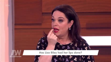 Lisa Riley Angered After Doctor Asked If Shed Had Lip Fillers Metro News