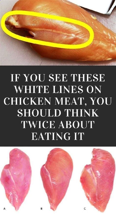 If You See These White Lines On Chicken Meat Health And Fitness Tips