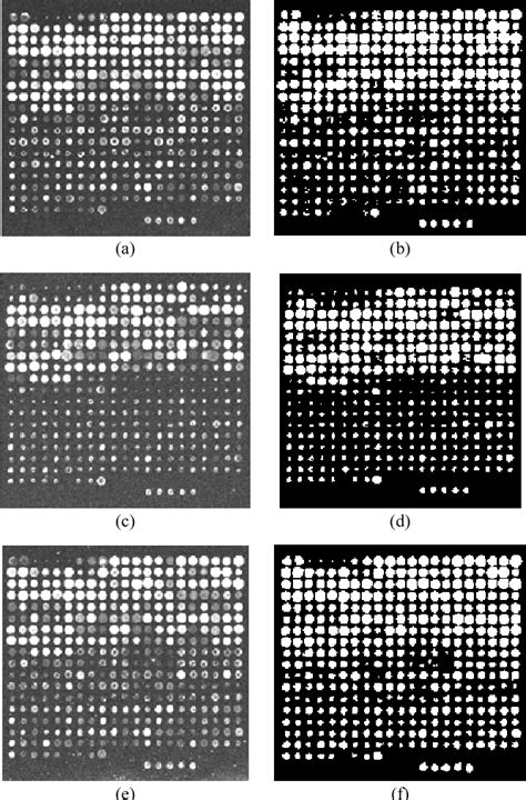 Figure 5 From Microarray Image Segmentation Using Chan Vese Active
