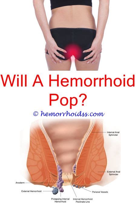 Mejor te hubieras quedado en tu pueblo, pinche culero. What Does Hemorrhoids Mean In Spanish? do hemorrhoids stay ...
