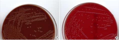 Colonies Of Neisseria Gonorrhoeae On Chocolate A And Open I