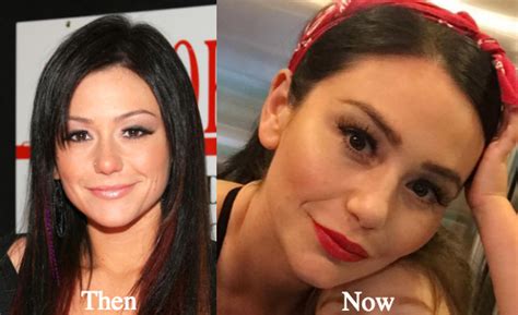 Jwoww Plastic Surgery Before And After Photos