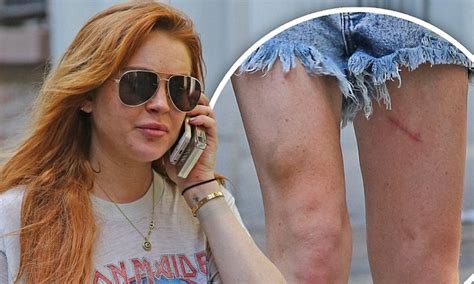 Lindsay Lohan Sports Cuts And Bruises On Her Legs On 28th Birthday Daily Mail Online