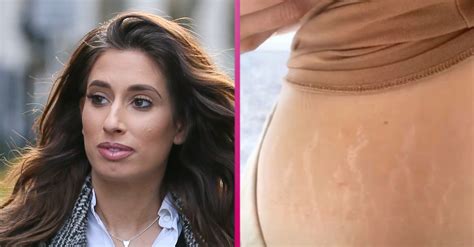 stacey solomon shows off her stretch marks entertainment daily