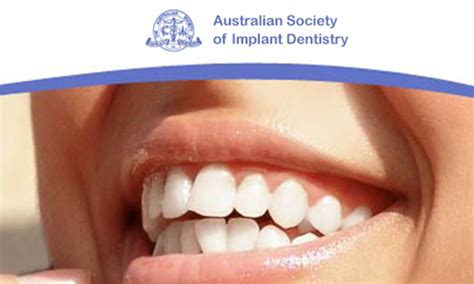 Australian Society Of Implant Dentistry Resources Mybestdentists