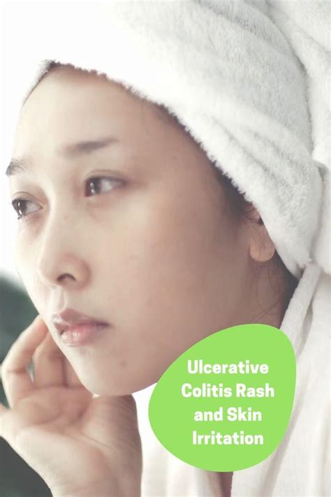 Ulcerative Colitis Rash And Skin Irritation