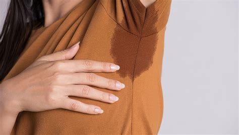 Understanding Hyperhidrosis Causes Symptoms And Treatment Options