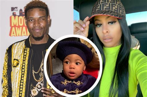 Fetty Wap And Alexis Skyys 1 Year Old Daughter Undergoes Emergency Brain