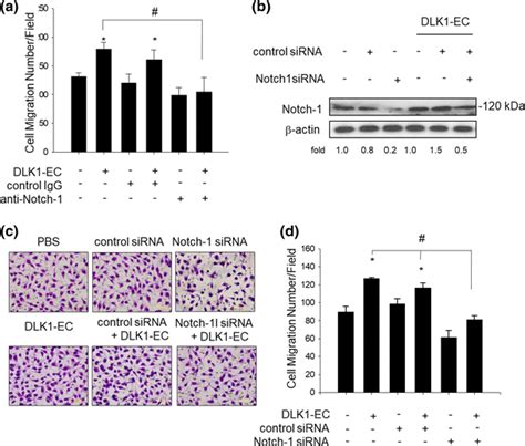 Effect Of Notch1 Inactivation On DLK1 EC Induced Angiogenesis In