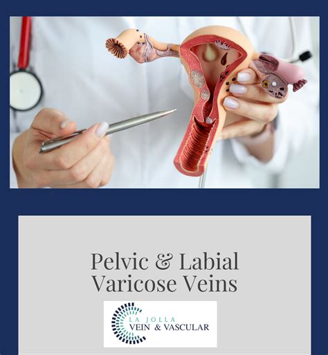 Pelvic And Labial Veins