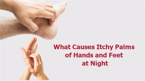 What Causes Itchy Palms Of Hands And Feet At Night