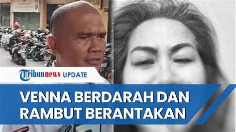 Beredar Foto Diduga Venna Melinda Bercucuran Darah Seusai Laporkan Kdrt Ferry Irawan Di Kediri