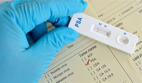 The Psa Test For Prostate Cancer Does As Much Harm As It Does Good