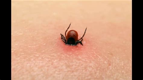 What Do Ticks Look Like On Humans Mice Images And Photos Finder