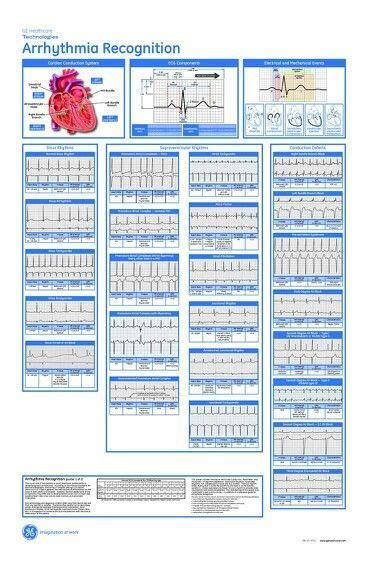 Cardiac Rhythm Cheat Sheet Printable Arrhythmia Recognition Acls