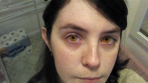 Amber Contacts By Maltesesparrow On Deviantart