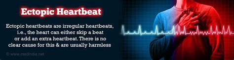 Ectopic Heartbeat Causes Symptoms Diagnosis Treatment Complications