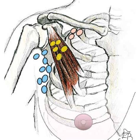 Three Anatomical Levels Of Axillary Lymph Nodes Level I Blue Lymph