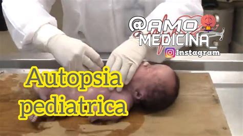 La Autopsia De Un Recién Nacido Amomedicina Youtube