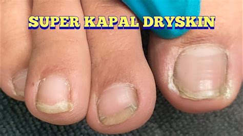 Dirt Under Long Toenail And Clean It Youtube