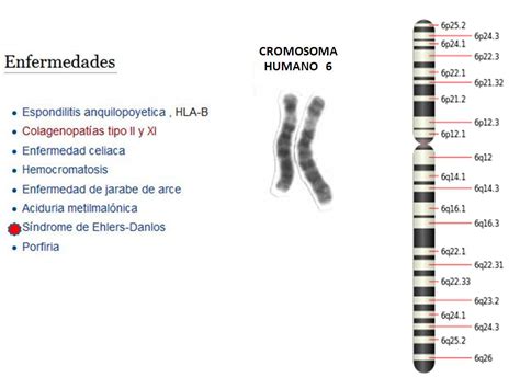 Ehlers Danlos Enlaces Argentina Genes Y Cromosomas En El Ehlers Danlos