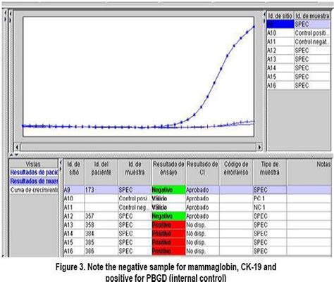 Rapid Detection Of Sentinel Lymph Node Metastases In Different