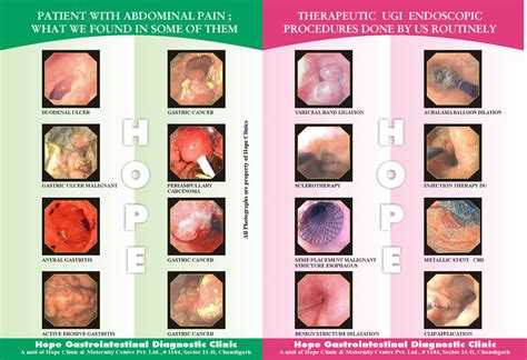 Upper Gastrointestinal Endoscopy