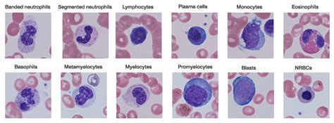 Forms Of Leukocytes Medical Laboratories