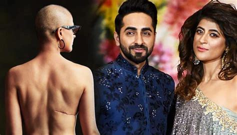 Ayushmann Khurranas Wife Tahira Kashyap Shows Off Her Scars In