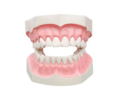 Partial Plate Denture Stock Photos Pictures And Royalty Free Images Istock