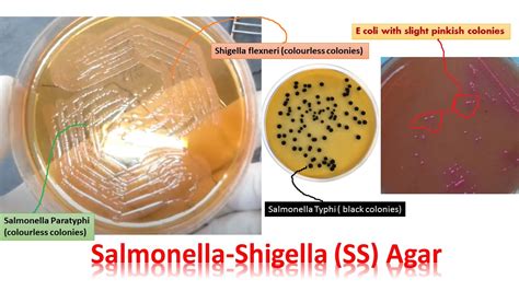 Cdc estimates salmonella bacteria cause about 1.35 million infections, 26,500 hospitalizations, and 420 deaths in the united states every year. Salmonella-Shigella (SS) Agar: Introduction, Composition ...