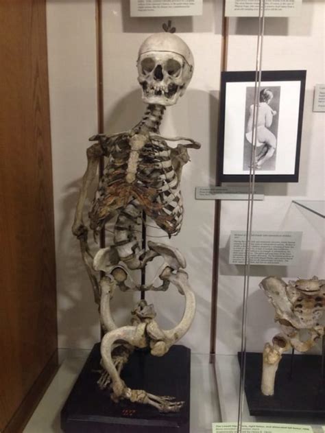 The Museum Of Medical Oddities In Massachusetts Is Not For The Faint Of