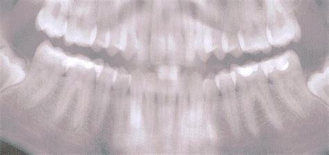 How Much Do Dental Hygienists Make? | Goodwin College