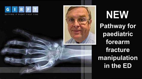 Pathway To Help Increase Paediatric Forearm Fracture Manipulation In
