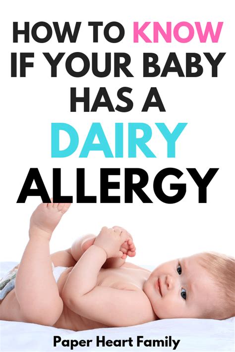 10 Milk Allergy Symptoms In Babies Milk Allergy Baby Dairy Allergy