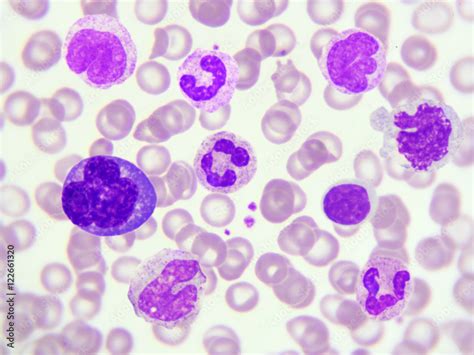 White Blood Cells In Peripheral Blood Smear Wright Stain Photos