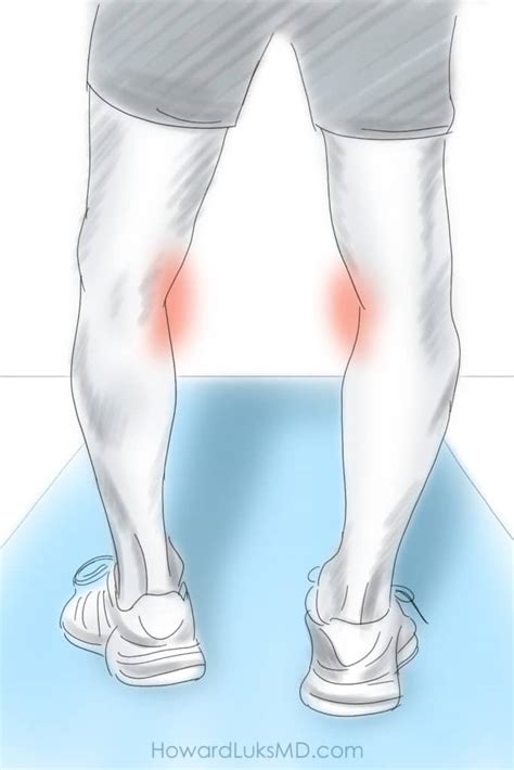 High Tibial Osteotomy For Knee Arthritis Pain In Active People