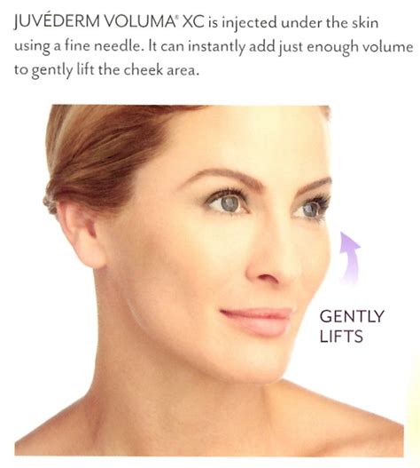 Using Fillers For Cheeks Charleston Facial Plastic Surgery