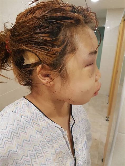 South Korean Teen Is Brutally Beaten By Bullies After Police Ignore Her