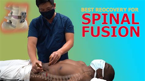 How We Treat A Spinal Fusion Physical Therapy Youtube