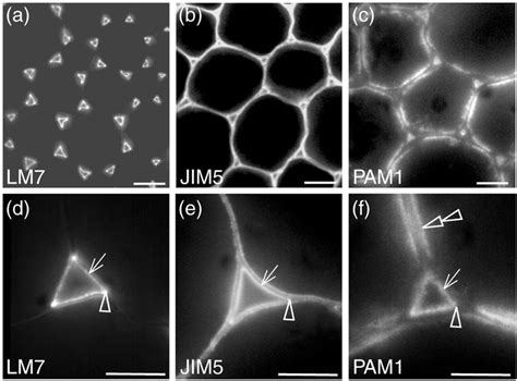 Gap junctions are a type of cell junction in which adjacent cells are connected through protein plant cells do not have gap junctions, but they do have plasmodesmata, which are channels that. The HG epitope recognized by LM7 occurs at cell junctions ...