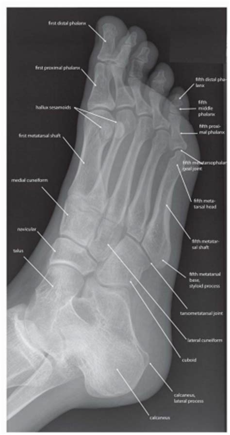 Check you have the right views. Diagnostic Imaging Techniques of the Foot and Ankle ...