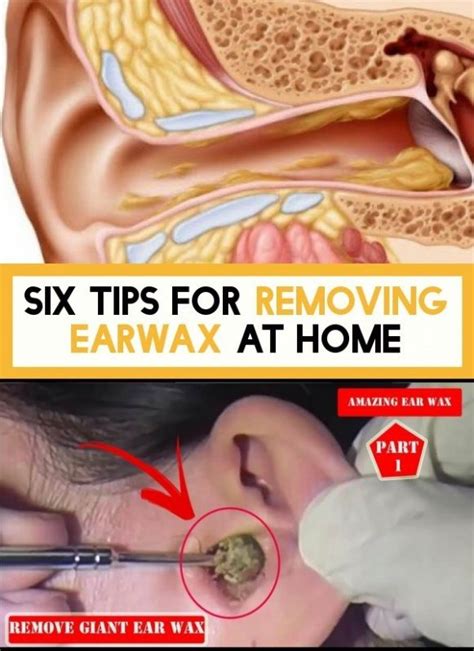 Six Tips On Earwax Removal In 2020 Ear Wax Natural Lubricant Tips