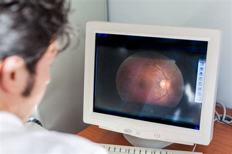 Optic Neuritis Typically Occurs In Adults Younger Than 45 More