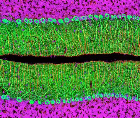 Purkinje Nerve Cells In The Cerebellum 6449277 Poster Framed Photos