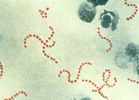 Streptococcus Bacteria In Groups A And B Facts And Diseases