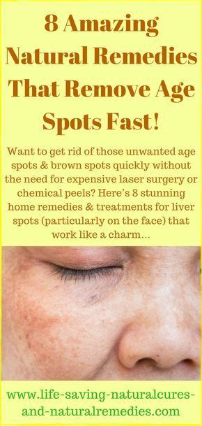 The 25 Best Age Spot Removal Ideas On Pinterest Age Spot Remedies