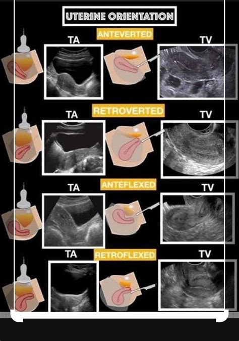 pin on gynecology