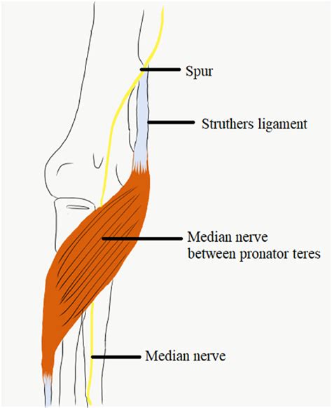 The Course Of Median Nerve In Relation To Pronator Teres Download
